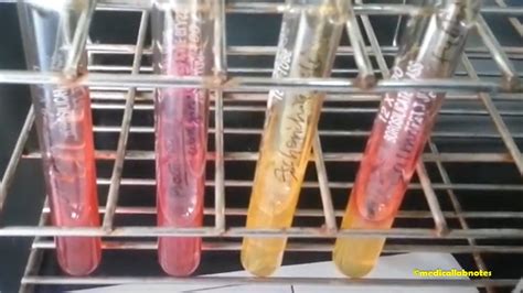 Triple Sugar Iron (TSI) Agar Test: Introduction, Composition, Princ.